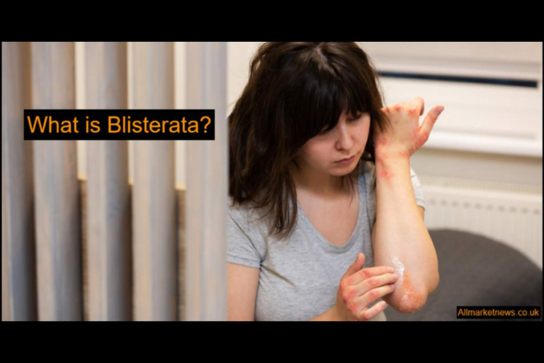 Blisterata Demystified: Causes, Diagnosis, and Effective Treatment